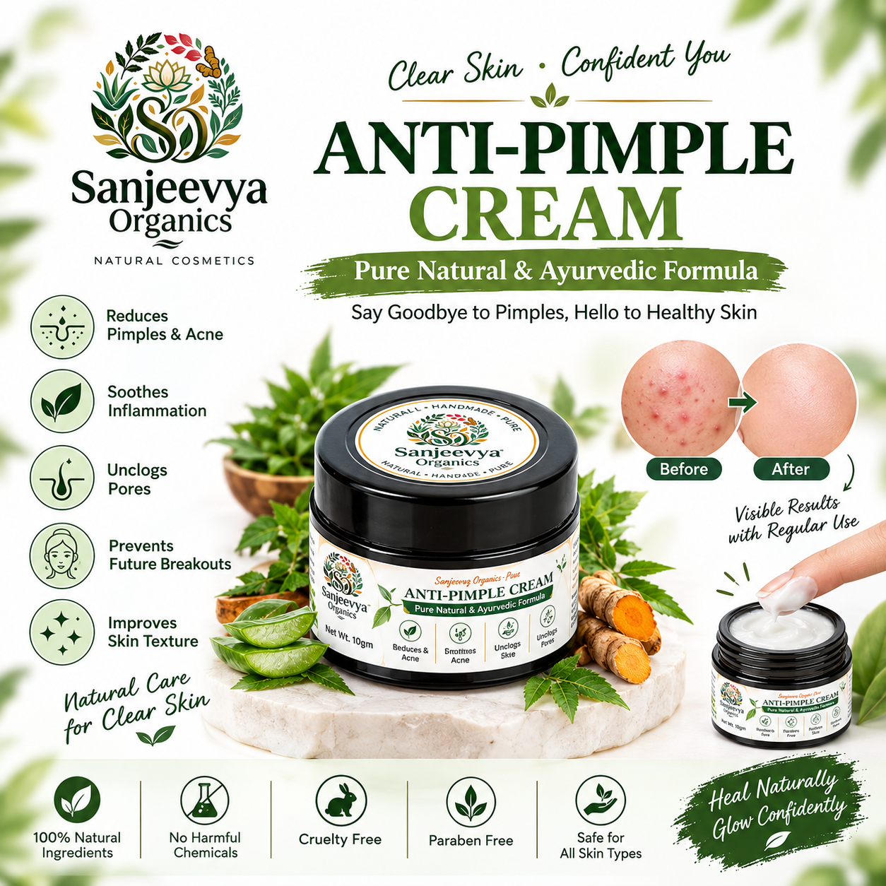Anti-Pimple Cream for Acne-Prone Skin