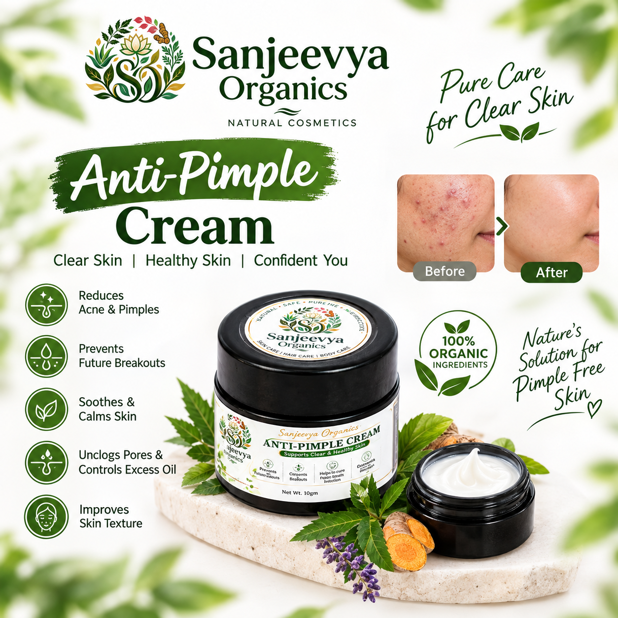 Anti-Pimple Cream for Acne-Prone Skin
